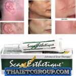SCAR ESTHETIQUE Scar cream post surgery keloid stretch marks reduce fade burns