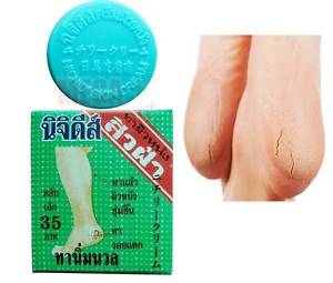 s-l300_d1b400e7-fd3b-41dd-87f1-e49fd0fc7fa4.jpg Buy NICHIDI Cracked Cream Skin On Hands Feet Knees and Elbows Soften Skin Cream 8.3g - Image 1